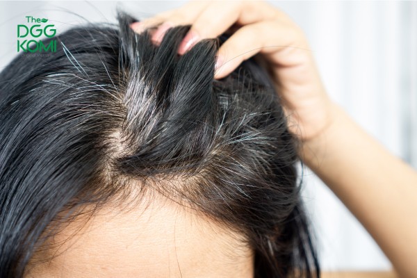 Ảnh hưởng xấu của tóc bạc sớm ở nữ giới 