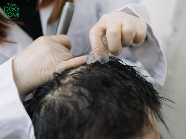 Cách xử lý khi tóc rụng nhiều ở nam giới 
